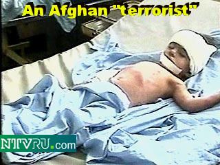 Afghan child injured by heros of the U.S. military