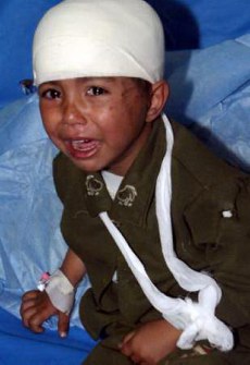 little boy crying, his head wrapped in bandages, bandages on his right hand, his left arm in a sling