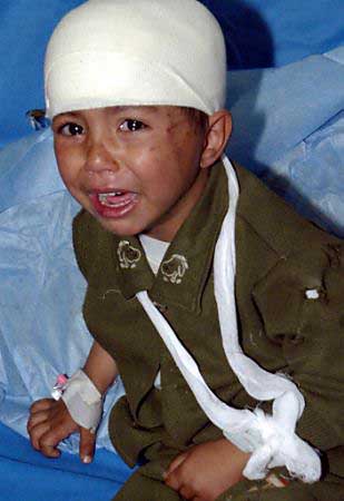 Photo of a darling little boy crying and looking fearful.  He's about three or four years-old, and his head is wrapped in bandages, with bandages on his right hand, and his left arm in a sling.  His big brown  eyes, full of tears, look at the viewer.
