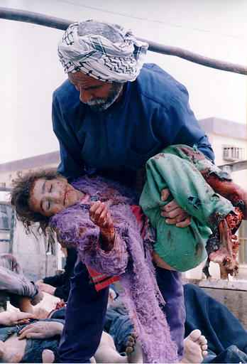 Photo of an older Iraqi man with a graying beard, looking sadly down at the corpse of a little girl as he carries her past a pile of other corpses. Her right foot has been almost completely severed off, it is hanging by a bit of bloody skin. Her other leg is bloody. Her body is frozen by rigor mortis with her right arm and hand held in the air. Her eyes are closed and there is dried blood on her beautiful little face.