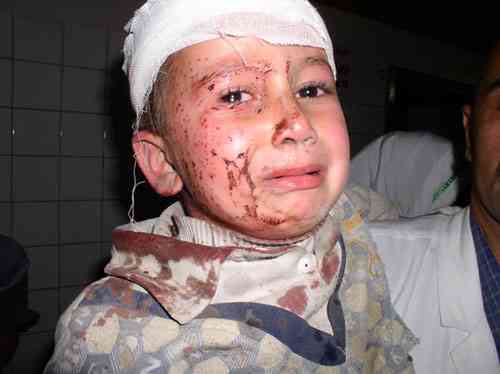 Photo of a young boy crying as he looks at the viewer; there are red marks and dried blood on the right side of his face, and dried blood on his shirt collar and shoulder.