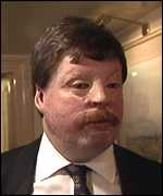 photograph of Simon Weston; his face was burned in the Falklands War, and the skin around his eyes in particular is now deformed by scar tissue.